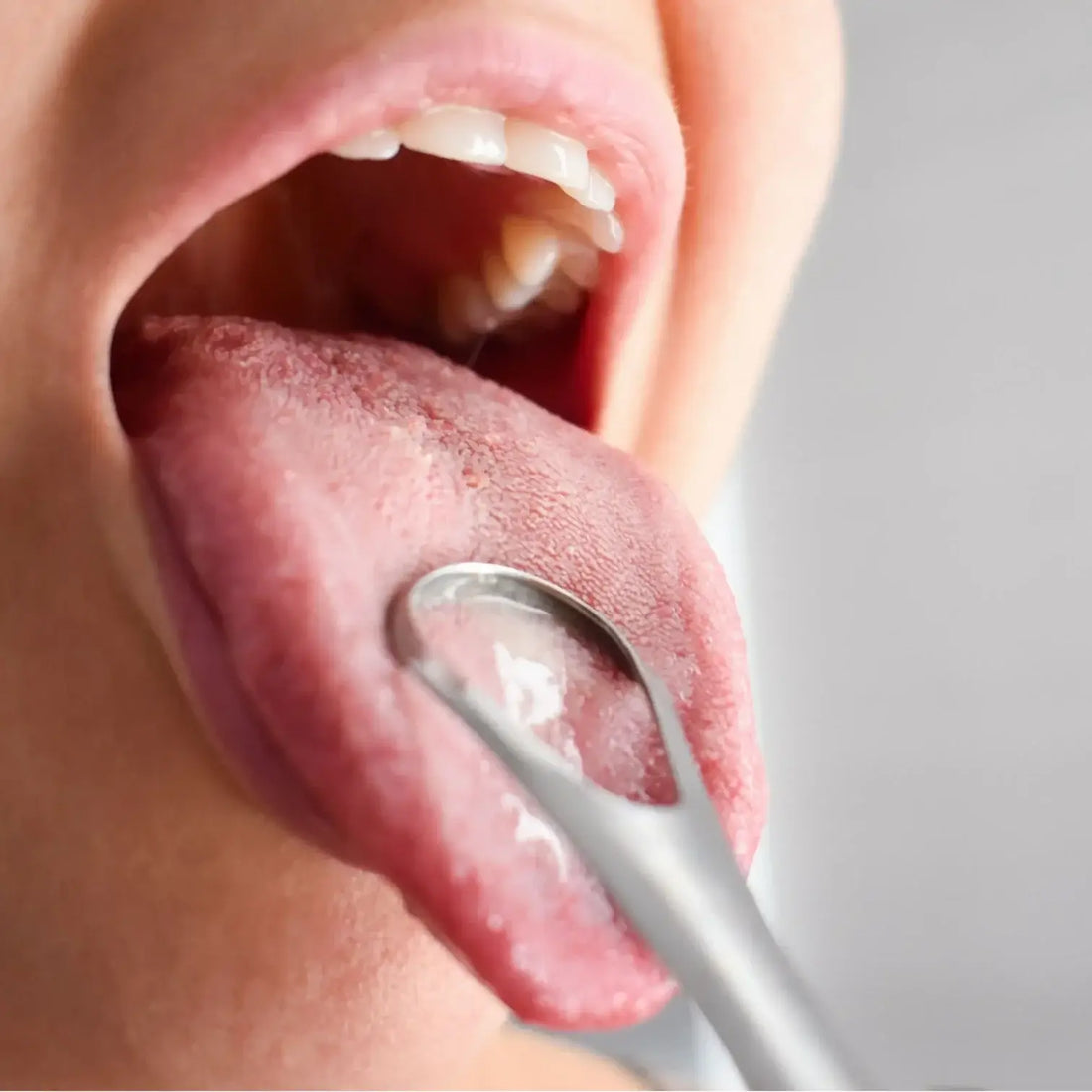 When to Use a Tongue Cleaner?