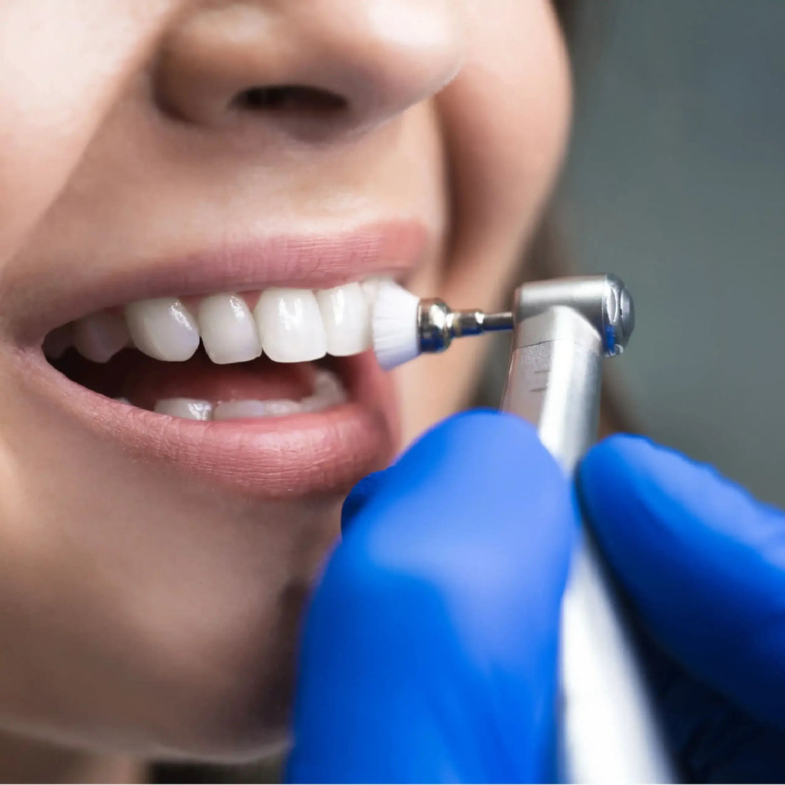 How to Perform Gentle Teeth Cleaning? - Docorp