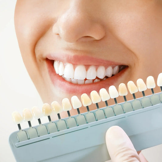 Things to Know About Teeth Whitening - Docorp